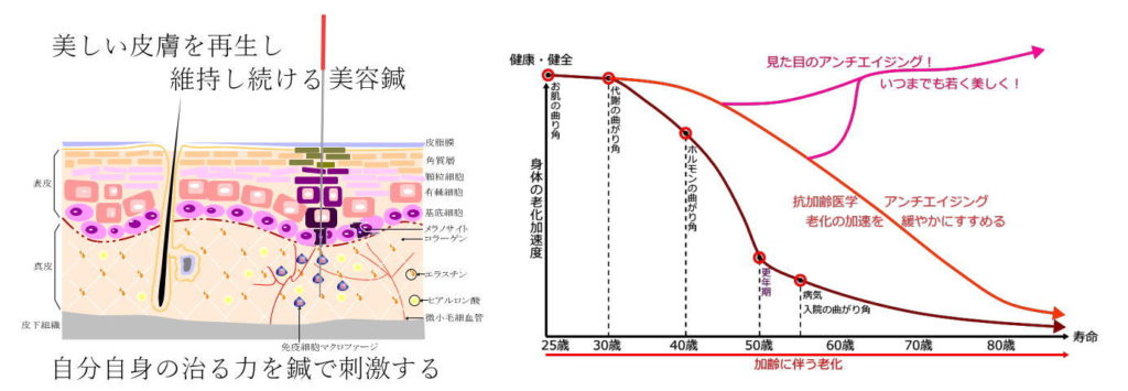 長谷川亮鍼灸院の美容鍼にご来院頂いている方。