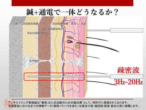 美容鍼と通電で一体どうなるか？